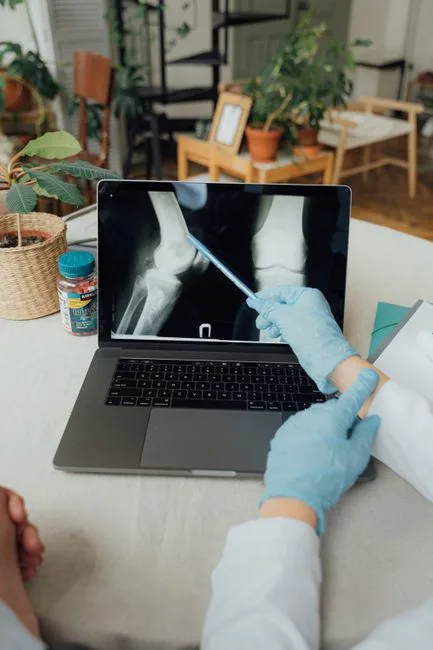Doctor reviewing a knee X-ray for joint pain diagnosis