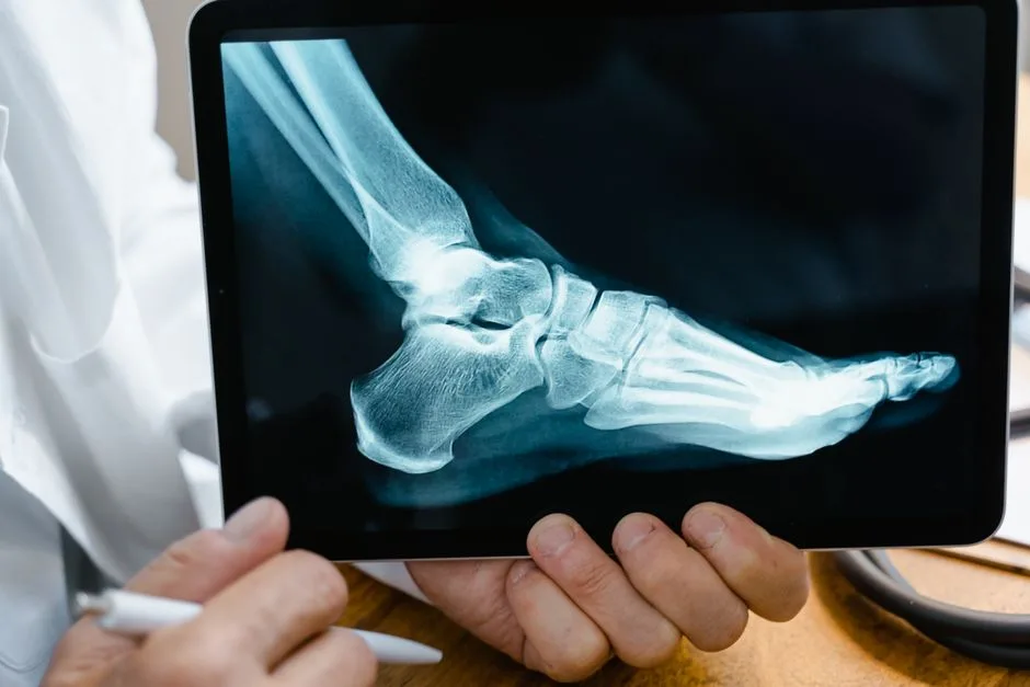 Doctor reviewing an ankle X-ray on a tablet